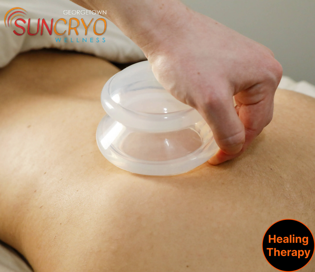 cupping-therapy-near-vietnam-veterans-memorial-at-georgetownsuncryo-washington-dc