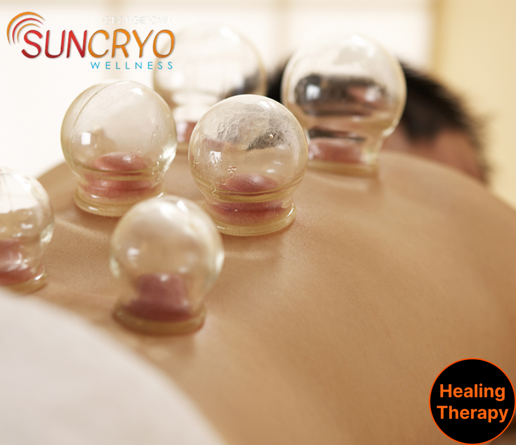 discover-the-best-cupping-therapy-near-the-national-museum-of-african-american-history-and-culture-georgetown-sun-cryo-washington-d-c