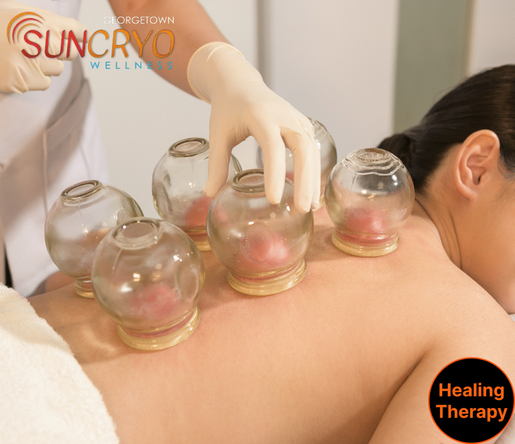 cupping-therapy-in-coconut-grove-miami-fl-georgetownsuncryo