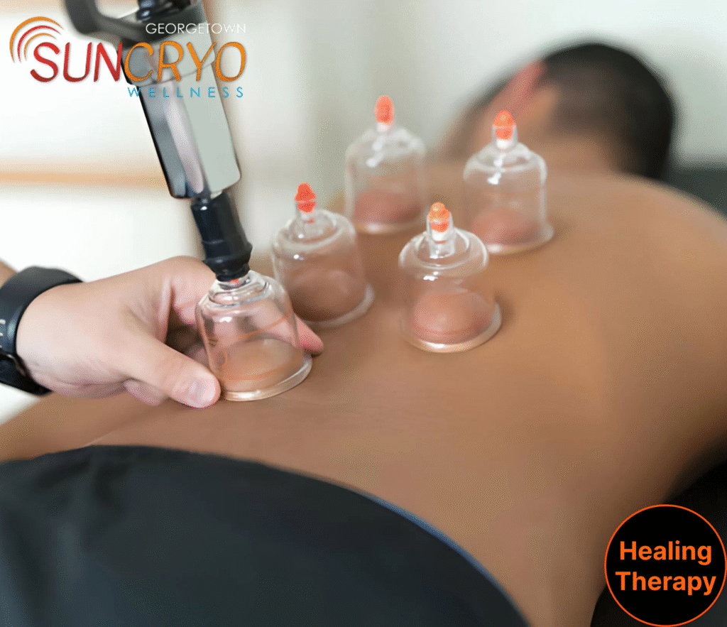 cupping-therapy-near-navy-pier-chicago-il-and-washington-dc-georgetown-suncryo