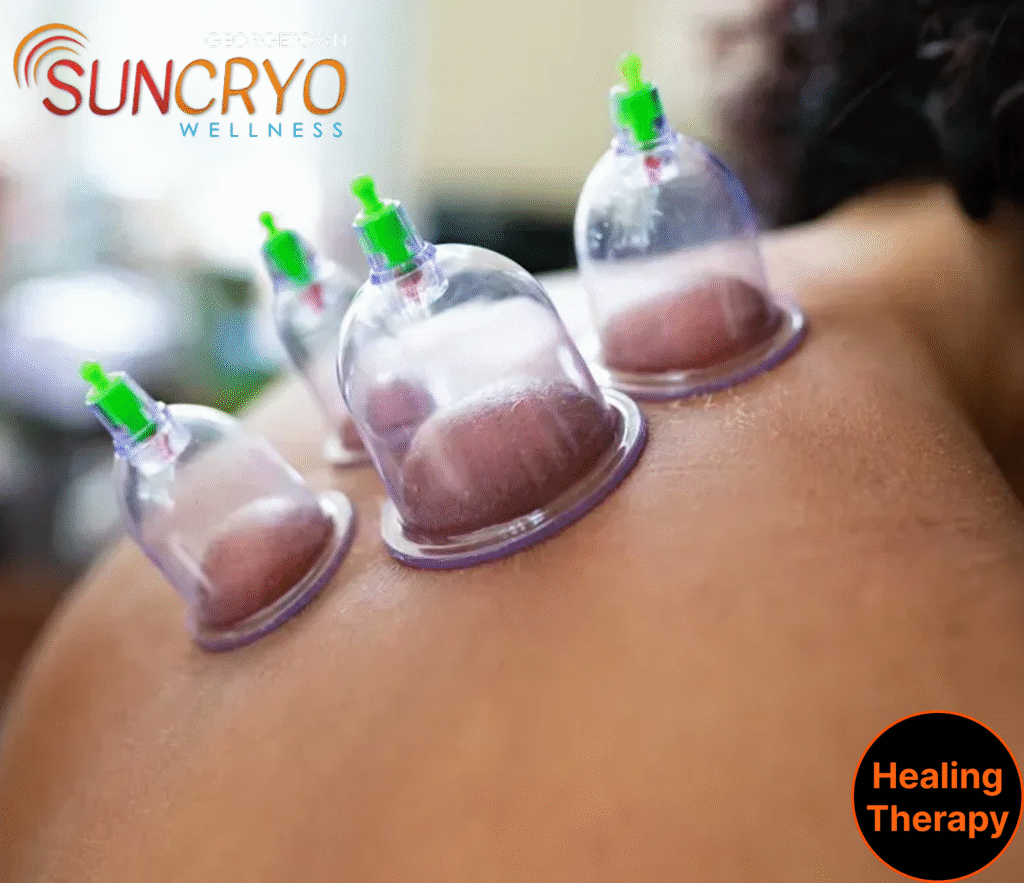 cupping-therapy-near-the-space-needle-seattle-wa-and-washington-dc-georgetown-suncryo