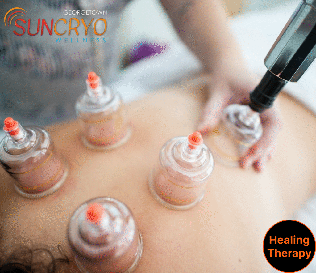 cupping-therapy-near-downtown-austin-tx-and-washington-dc-georgetown-suncryo-2