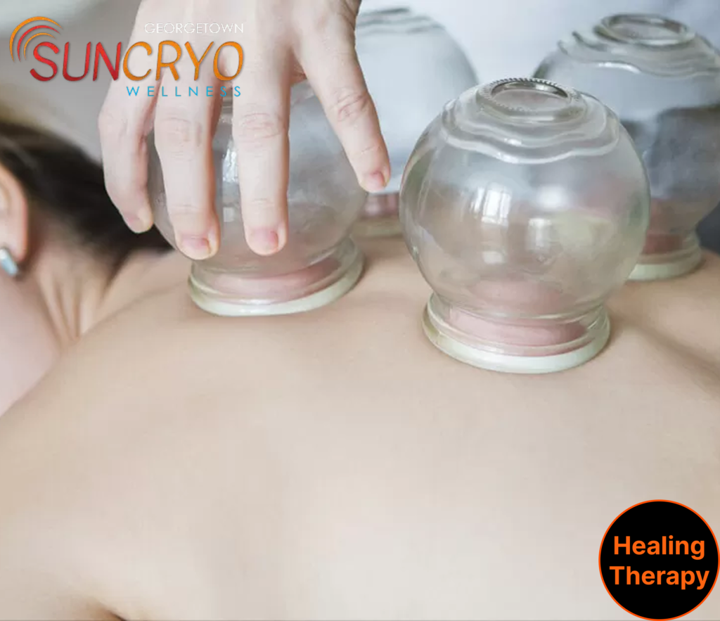 cupping-therapy-near-the-national-gallery-of-art-at-georgetownsuncryo