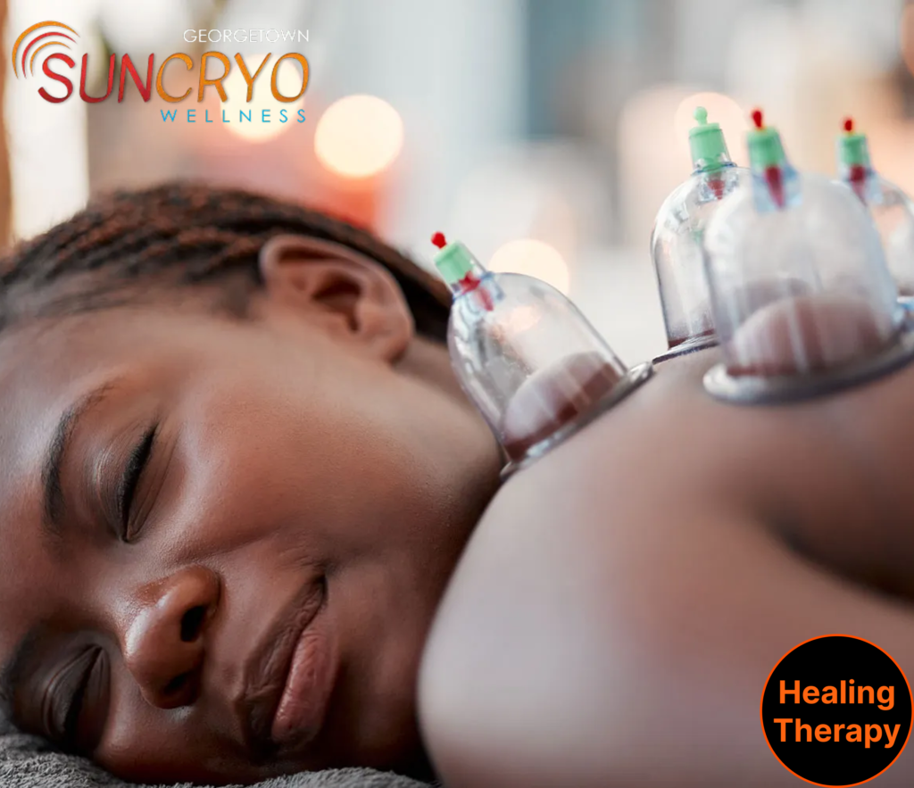 Cupping Therapy Near Rock Creek Park, Washington DC | Georgetownsuncryo