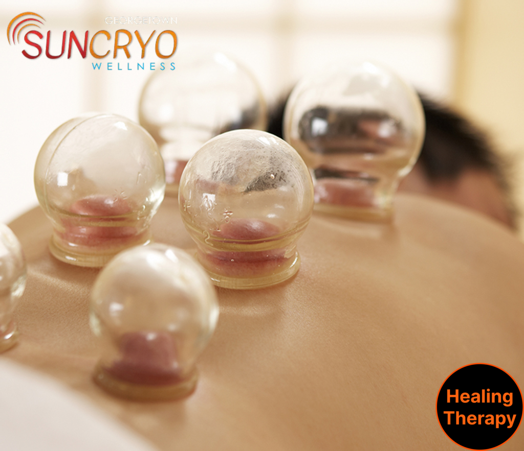 experience-cupping-therapy-near-smithsonian-museums-at-georgetownsuncryo-in-washington-dc
