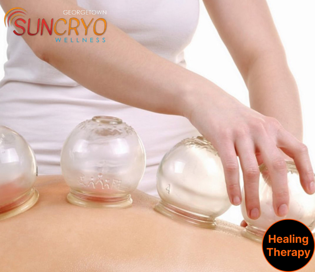 cupping-therapy-near-martin-luther-king-jr-memorial-at-georgetowncuncryo-washington-dc