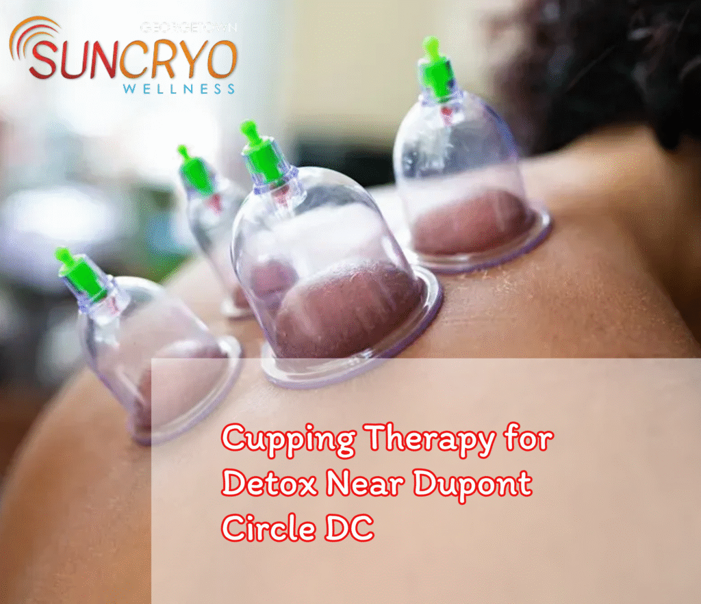 Cupping Therapy for Detox Near Dupont Circle DC