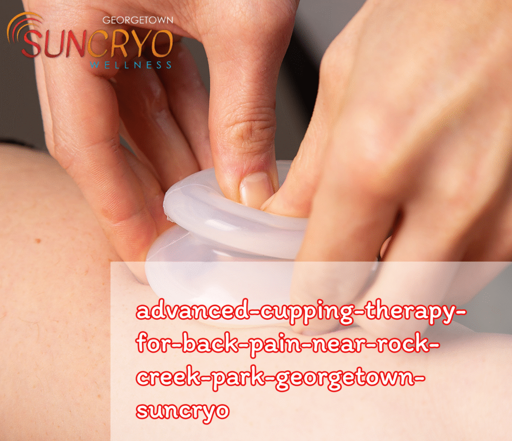 advanced-cupping-therapy-for-back-pain-near-rock-creek-park-georgetown-suncryo