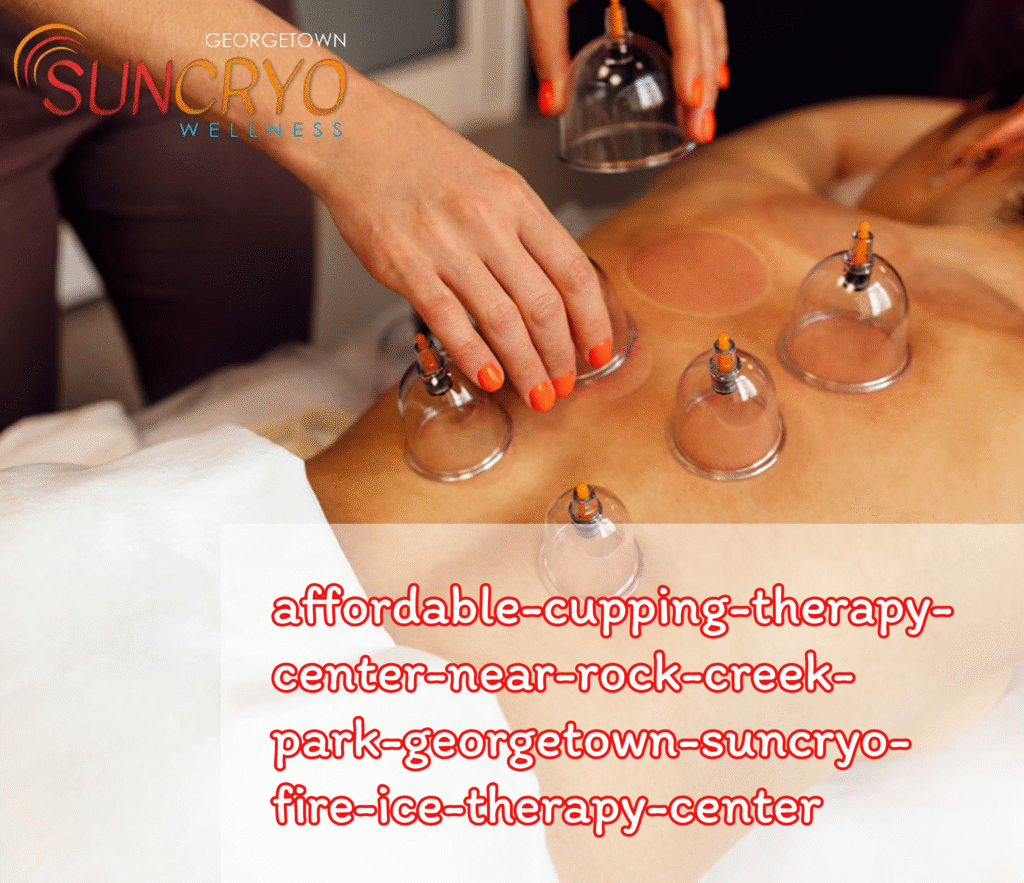 affordable-cupping-therapy-center-near-rock-creek-park-georgetown-suncryo-fire-ice-therapy-center