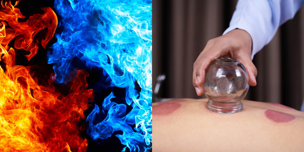 fire-ice-therapy-center-with-cupping-near-rock-creek-park-georgetown-dc