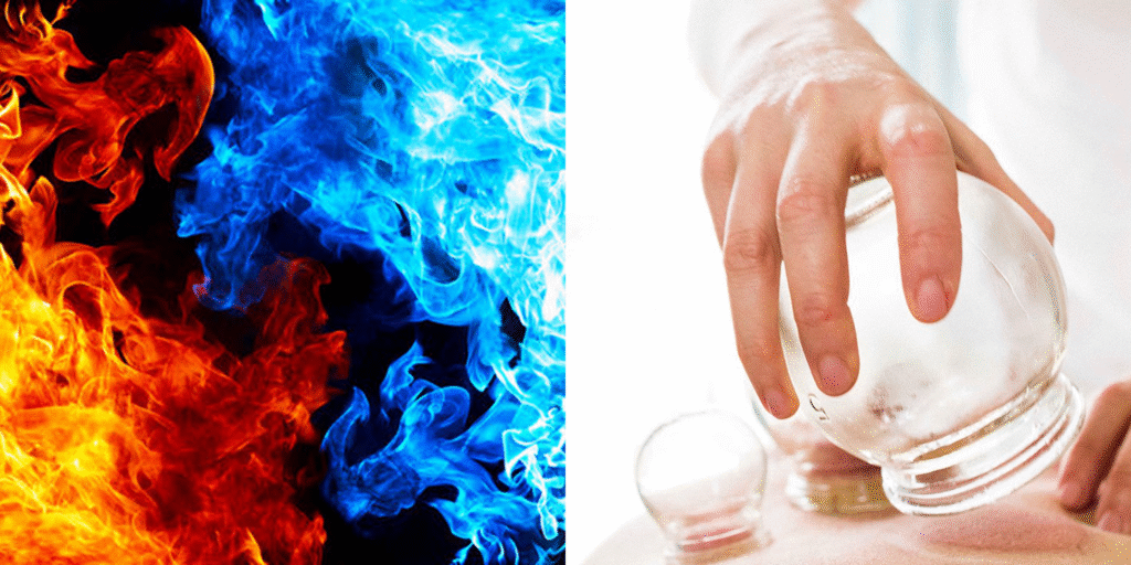 premium-cupping-therapy-center-packages-near-rock-creek-park-georgetown-suncryo-fire-ice-therapy-center