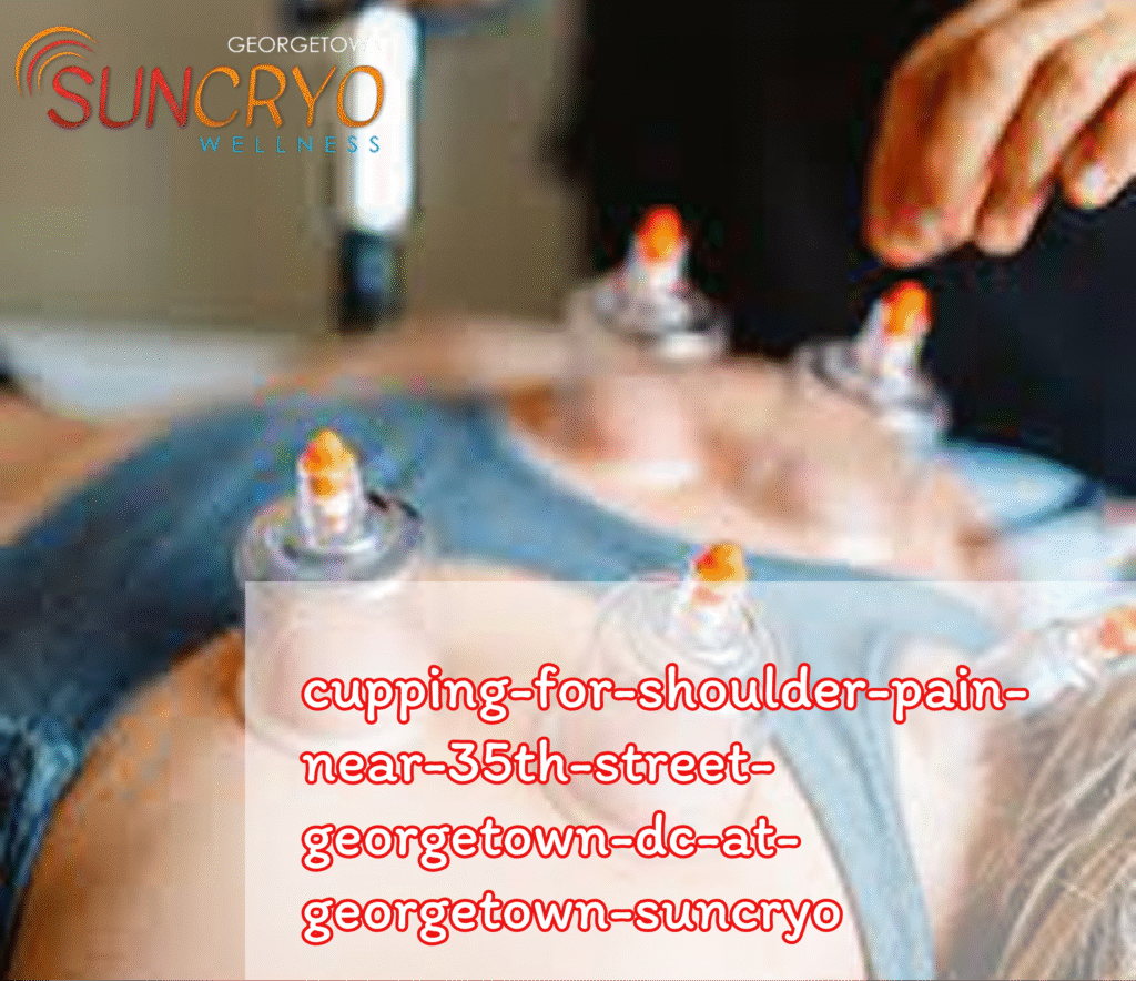 cupping-for-shoulder-pain-near-35th-street-georgetown-dc-at-georgetown-suncryo