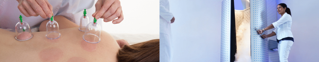 cupping-for-pain-relief-with-cryotherapy-near-georgetown-library-dc-at-georgetown-suncryo