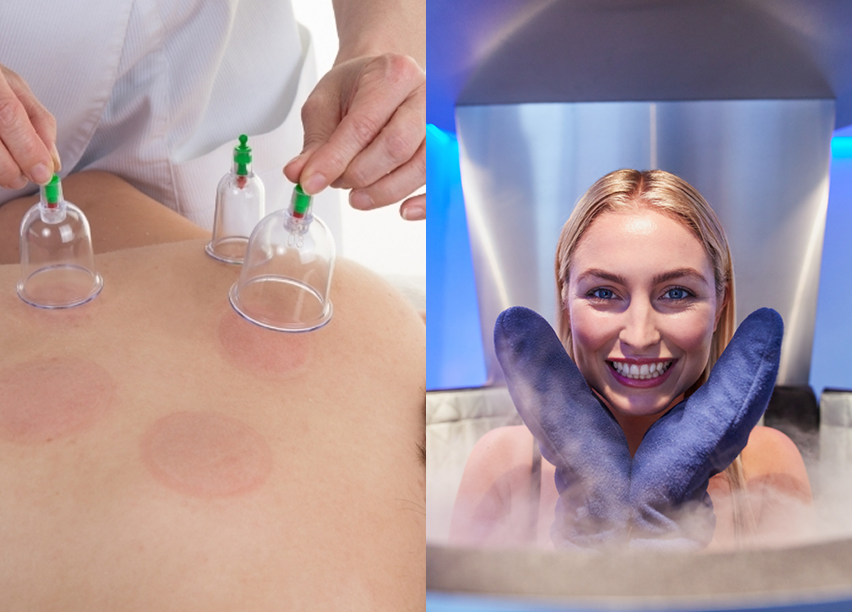 cupping-pain-relief-therapy-near-georgetown-waterfront-park-dc-at-georgetown-suncryo