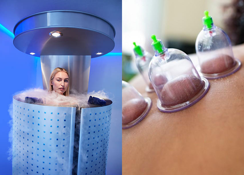 cryotherapy-and-cupping-for-pain-relief-near-georgetown-university-at-georgetown-suncryo