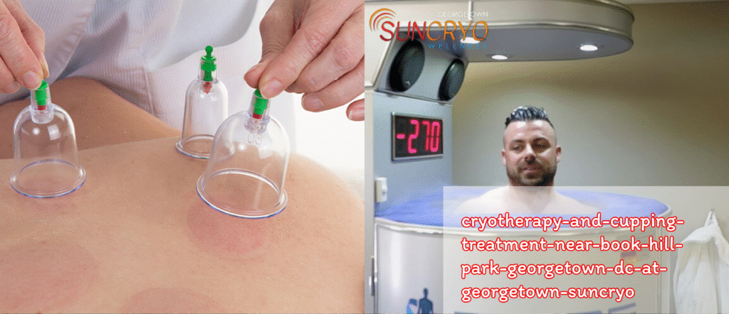 cryotherapy-and-cupping-treatment-near-book-hill-park-georgetown-dc-at-georgetown-suncryo