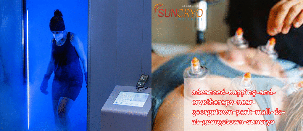 advanced-cupping-and-cryotherapy-near-georgetown-park-mall-dc-at-georgetown-suncryo