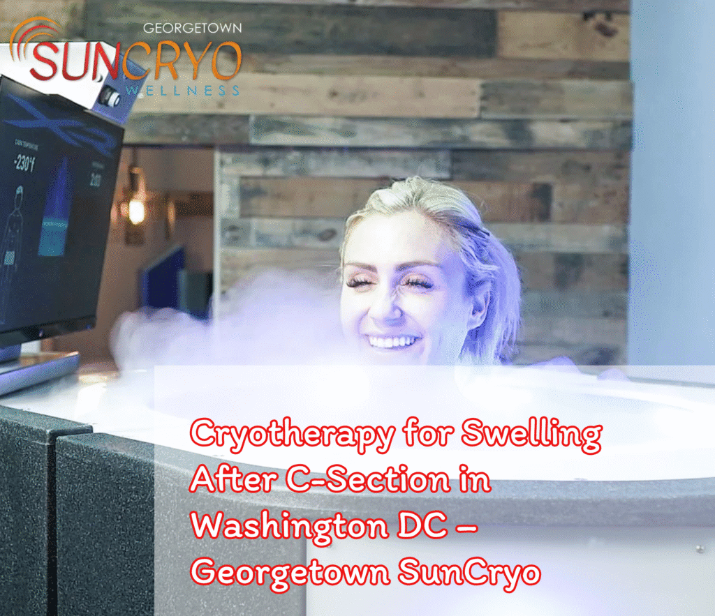 Cryotherapy for Swelling After C-Section in Washington DC – Georgetown SunCryo