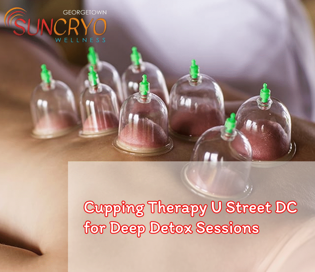 Cupping Therapy U Street DC for Deep Detox Sessions