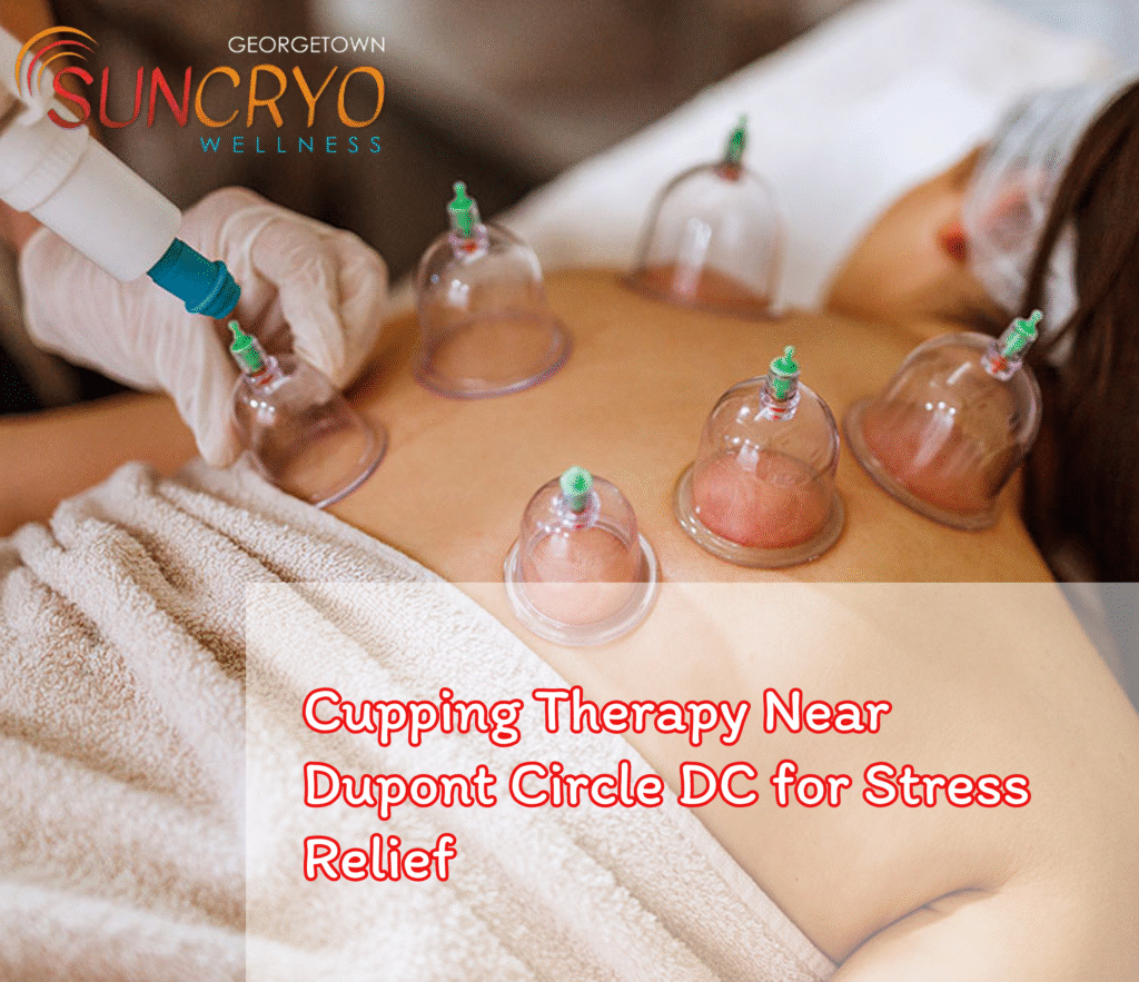 Cupping Therapy Near Dupont Circle DC for Stress Relief