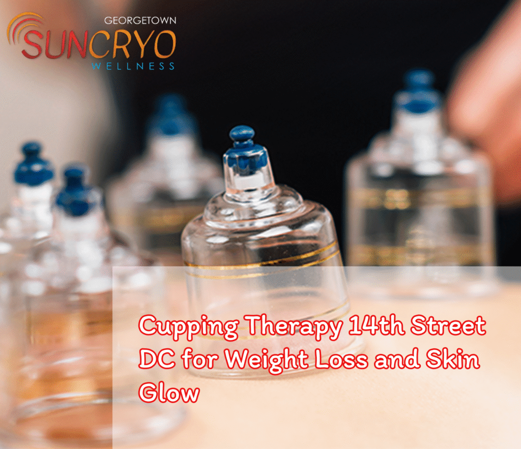 Cupping Therapy 14th Street DC for Weight Loss and Skin Glow