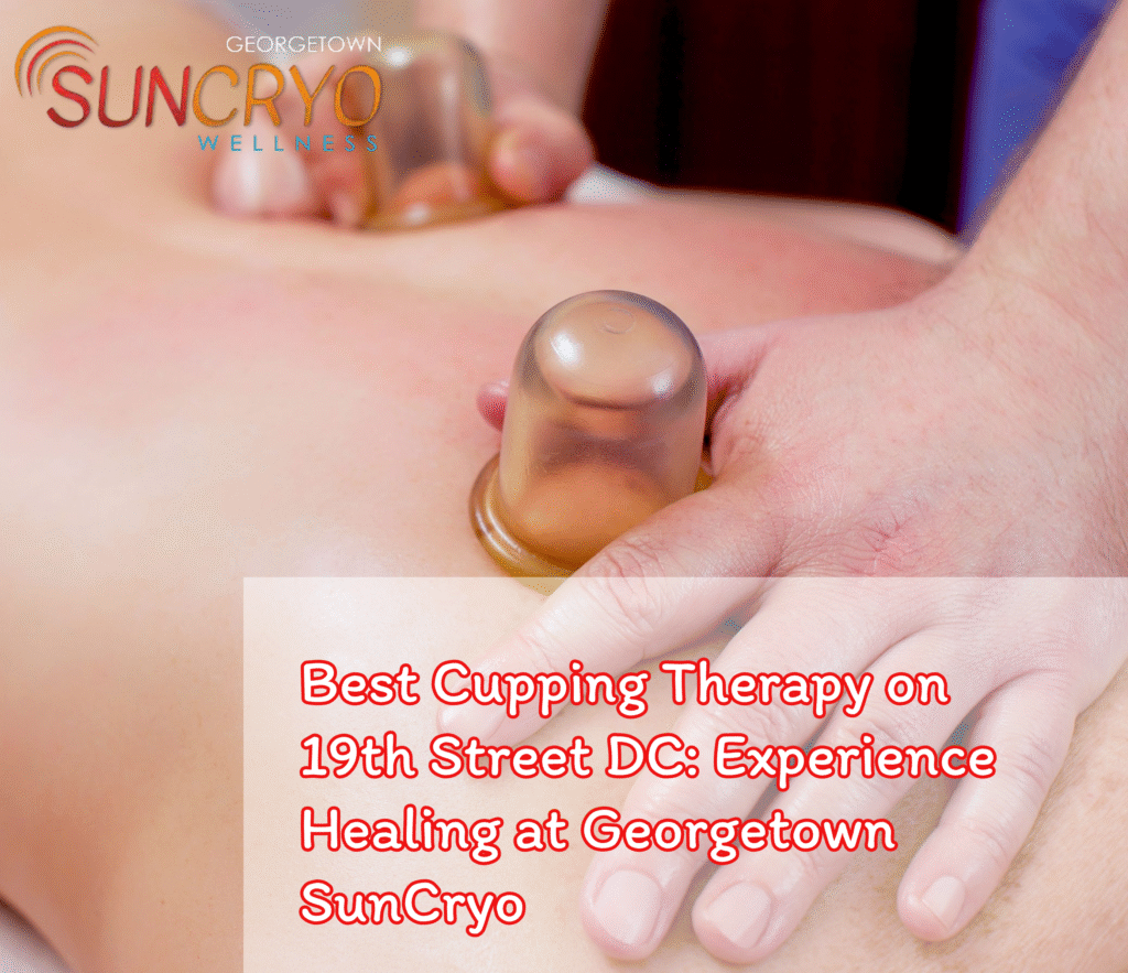 Best Cupping Therapy on 19th Street DC: Experience Healing at Georgetown SunCryo