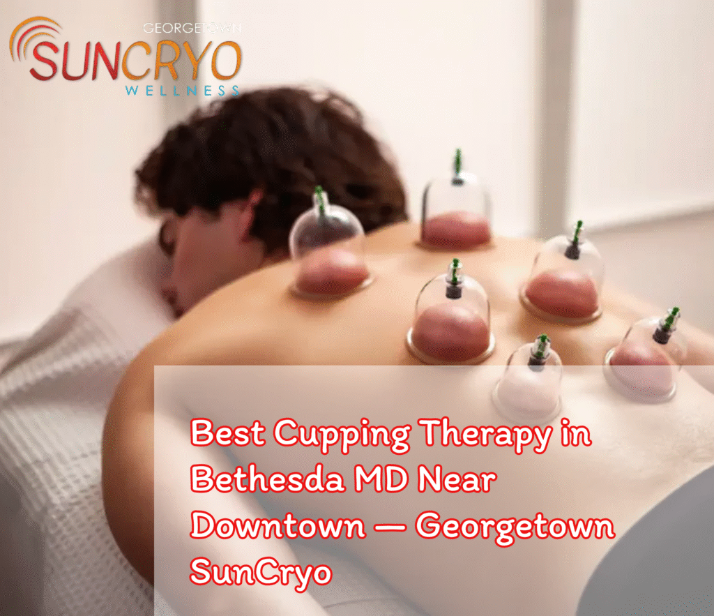 Best Cupping Therapy in Bethesda MD Near Downtown — Georgetown SunCryo