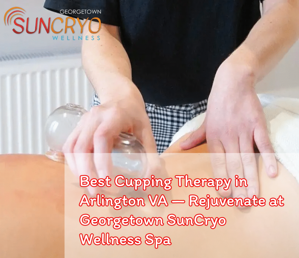 Best Cupping Therapy in Arlington VA — Rejuvenate at Georgetown SunCryo Wellness Spa