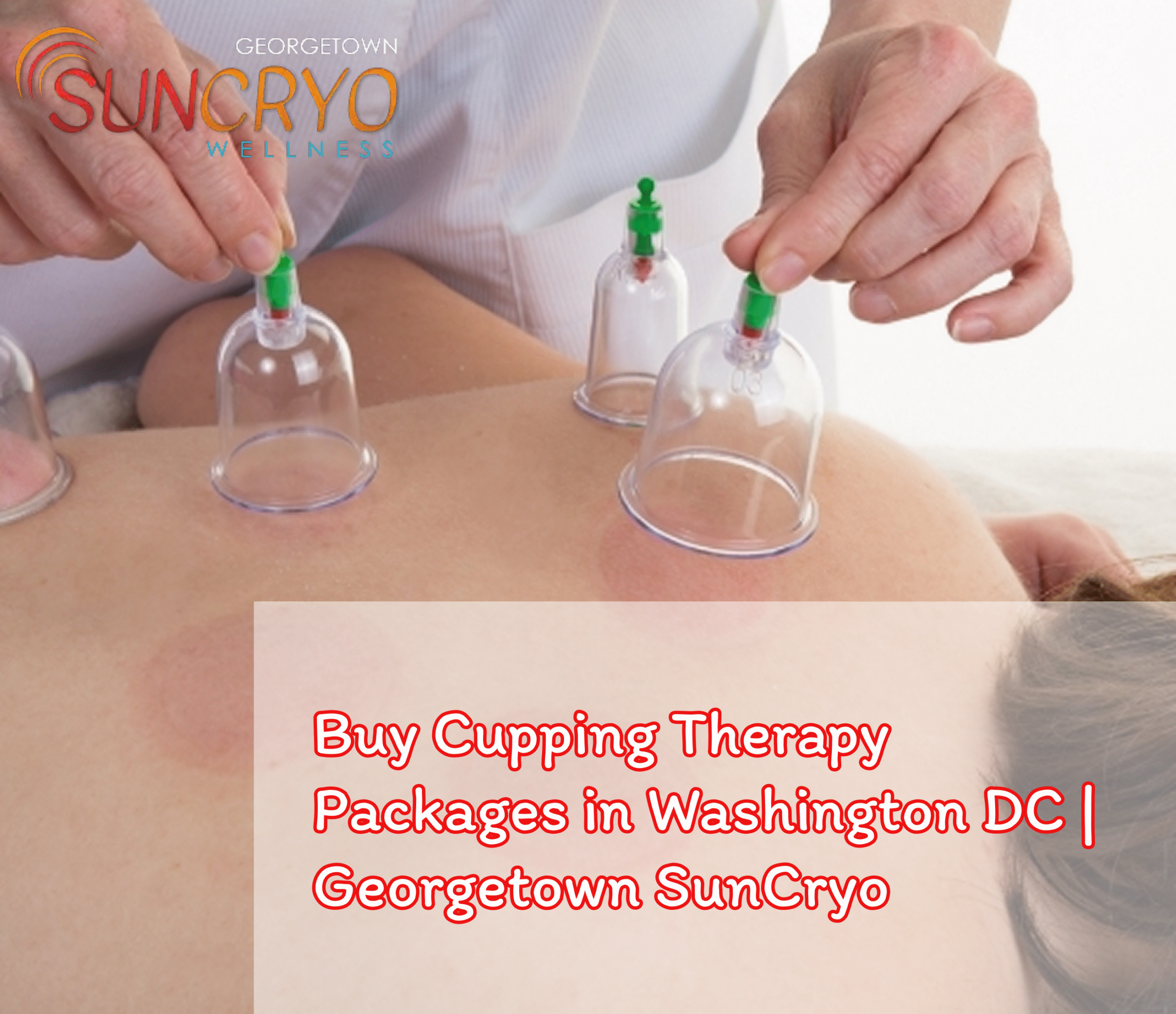 Buy Cupping Therapy Packages in Washington DC | Georgetown SunCryo